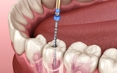 Dental Touch and Orthodontics
