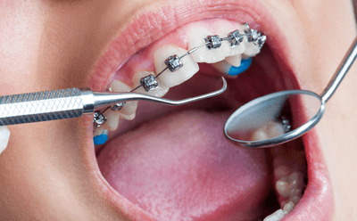 Dental Touch and Orthodontics