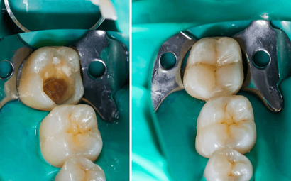 Dental Touch and Orthodontics