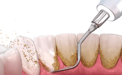 Dental Touch and Orthodontics